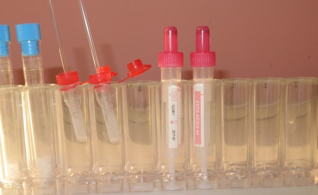 Zbiorowe zatrucie w gimnazjum w Przejazdowie: Wykluczono narkotyki