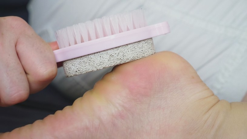 Zbyt częste stosowanie pumeksu może zaszkodzić stopom /123RF/PICSEL