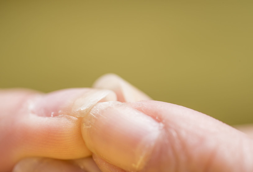 Zbyt długie moczenie dłoni w wodzie i brak rękawiczek ochronnych podczas mycia naczyń detergentami mogą osłabić paznokcie /123RF/PICSEL