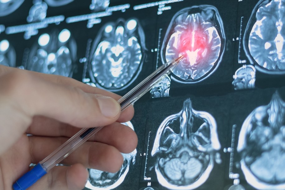 zdj. ilustracyjne/ Kiedy bomba tyka? /Shutterstock