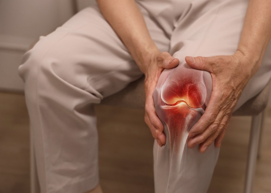 zdj. ilustracyjne/Koniec z bólem kolan? Nowa terapia choroby zwyrodnieniowej stawów /Shutterstock