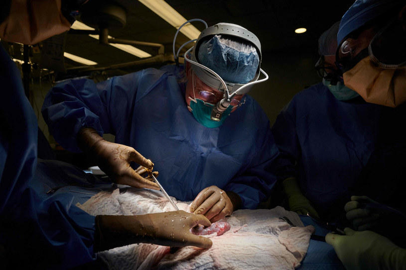 (Zdj. ilustracyjne) Operacja w Langone Transplant Institute /JOE CARROTTA /East News