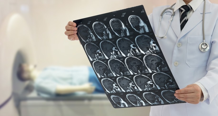 zdj. ilustracyjne/Szokujące zdjęcie – pasożyt w głowie pacjenta. Ratownik medyczny ostrzega /Shutterstock