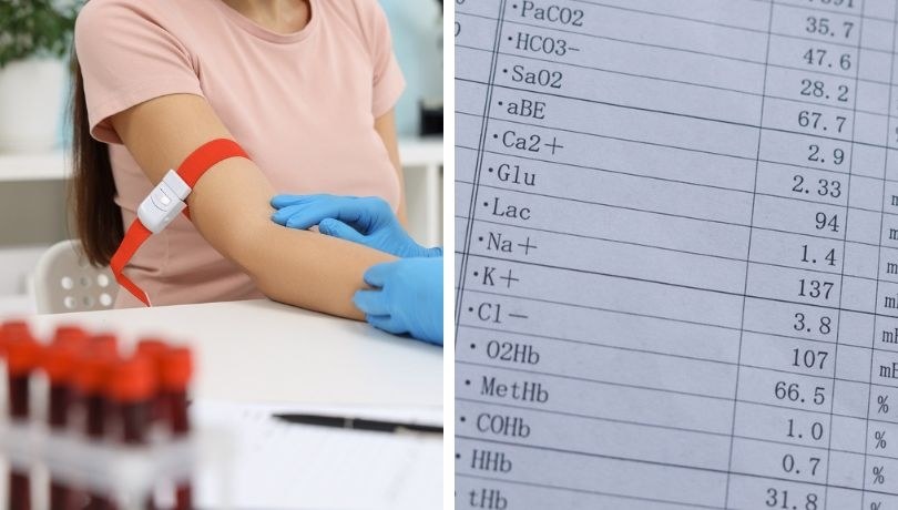 zdj. ilustracyjne / Wiele z badań laboratoryjnych można wykonać bezpłatnie - w ramach świadczeń finansowanych przez Narodowy Fundusz Zdrowia. /Shutterstock
