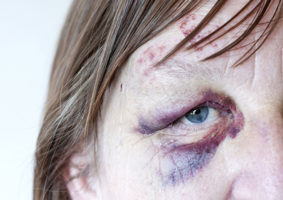 Ekspert: Decyzja ws. konwencji antyprzemocowej powinna być jak najszybsza