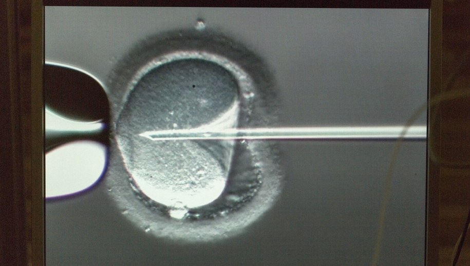 Dawca spermy pozywa klinikę. Odkrył, że został ojcem 17 dzieci