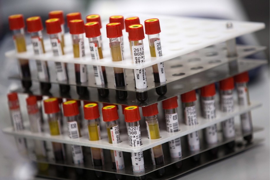 Leczenie COVID-19 osoczem: Pobrano krew od pierwszych ozdrowieńców