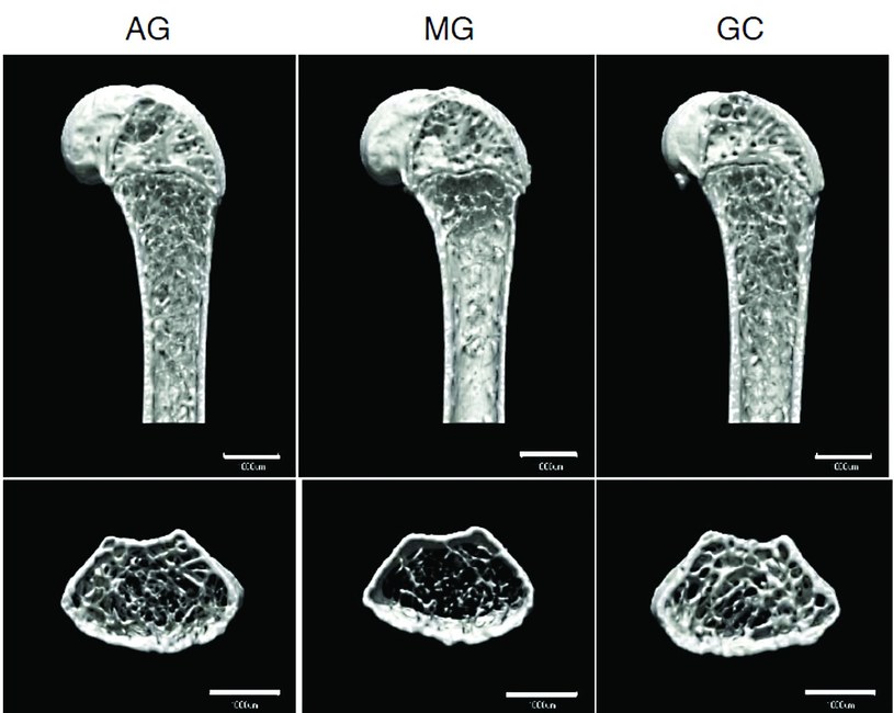 Zdjęcia kości udowej wykonane za pomocą mikrotomografii komputerowej. Kość wystawiona na stan nieważkości jest widoczna po środku (MG - microgravity). Wyraźnie widać zubożoną strukturę kości, szczególnie w przekroju poprzecznym u dołu grafiki.