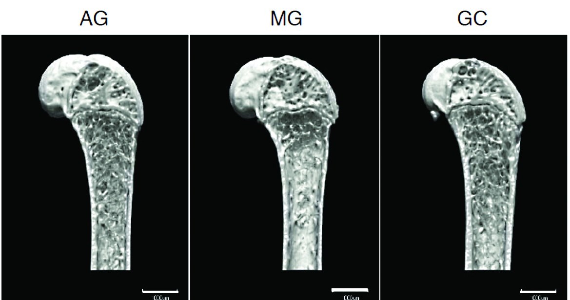 Zdjęcia kości udowej wykonane za pomocą mikrotomografii komputerowej. Kość wystawiona na stan nieważkości jest widoczna po środku (MG - microgravity). Wyraźnie widać zubożoną strukturę kości, szczególnie w przekroju poprzecznym u dołu grafiki.