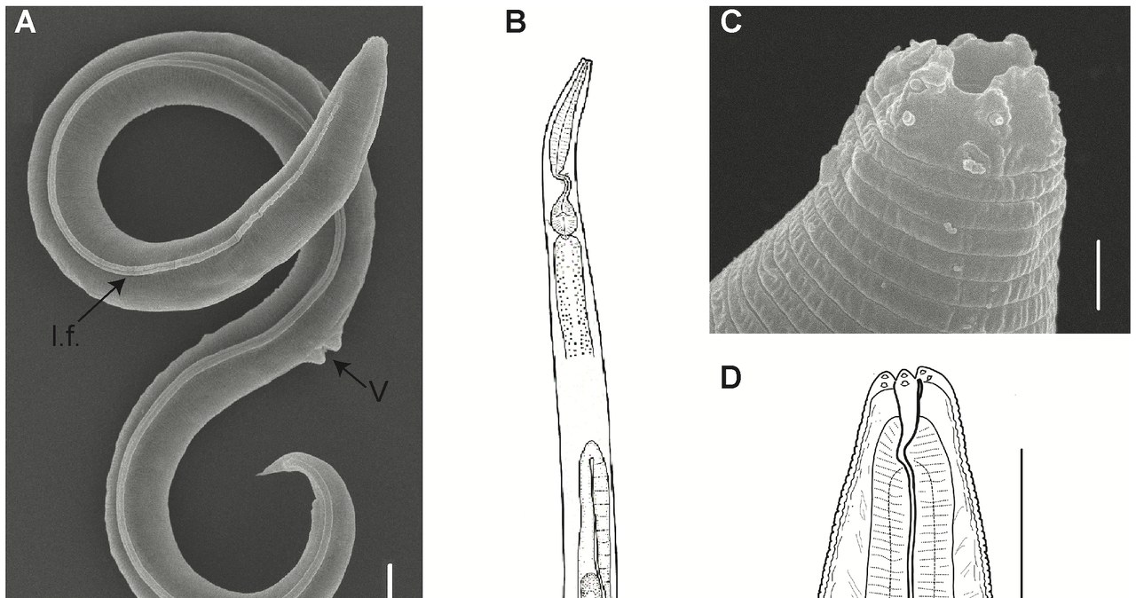 Zdjęcia mikroskopowe ożywionego nicienia. /S. A. Gade VR et al. (2023) A novel nematode species from the Siberian permafrost shares adaptive mechanisms for cryptobiotic survival with C. elegans dauer larva. PLoS Genet 19(7)/CC BY 4.0 /materiał zewnętrzny