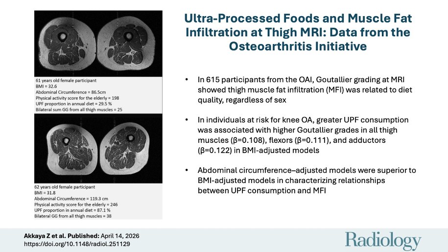 Zdjęcia opublikowane w badaniu Ultra-processed Foods and Muscle Fat Infiltration at Thigh MRI: Data from the Osteoarthritis Initiative /Radiological Society of North America (RSNA) /Materiały prasowe