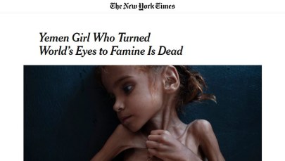 Zdjęcie Amal stało się symbolem głodu w Jemenie. Zmarła w wieku 7 lat