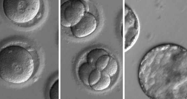Zdjęcie genetycznie zmodyfikowanych embrionów /Fot. Oregon Health & Science University /materiały prasowe