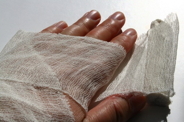 Francuzi zapowiadają "drukowanie" ludzkiej skóry w 3D