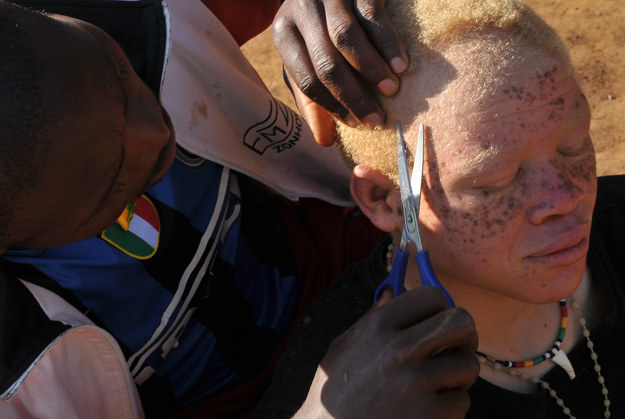 W Tanzanii zakazali czarów. Chcą obronić albinosów