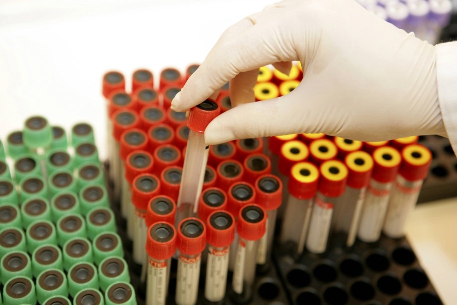 Epidemia HIV w rosyjskim Jekaterynburgu. "Sytuacja jest dramatyczna"