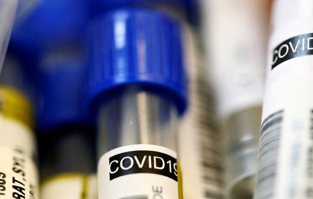 Onet: Ekspresowe testy na koronawirusa w Polsce już kwietniu