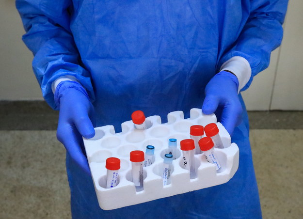 "Martwy wirus" dawał u ozdrowieńców fałszywy wynik testu koronawirusa