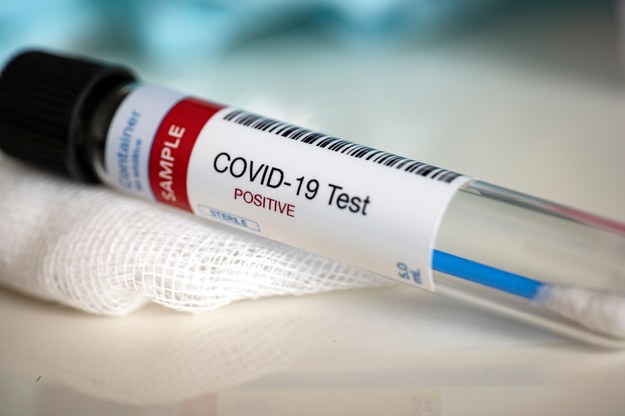 Od dziś nowe zasady testowania na koronawirusa