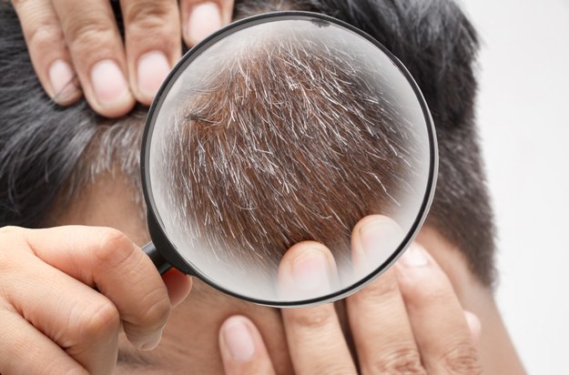 Proces siwienia włosów być może da się odwrócić