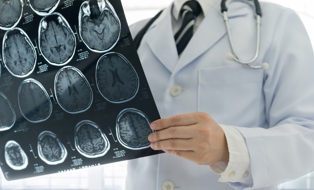 Neurologia w Koszalinie chce wznowić pracę. Lekarze pilnie poszukiwani