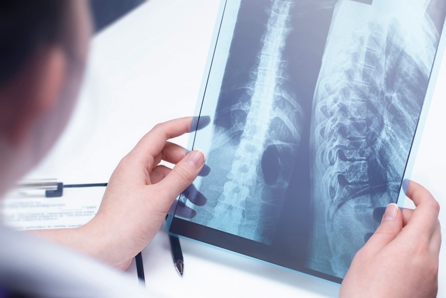 Lidzbark Warmiński pomoże uczniom z wadami postawy