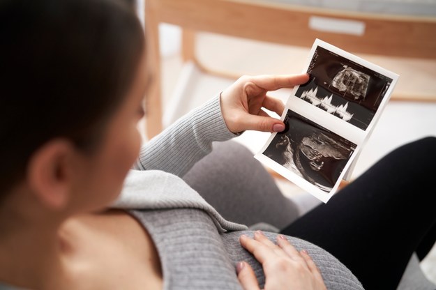 Urodziła się z dwiema macicami. Jest w "podwójnej" ciąży