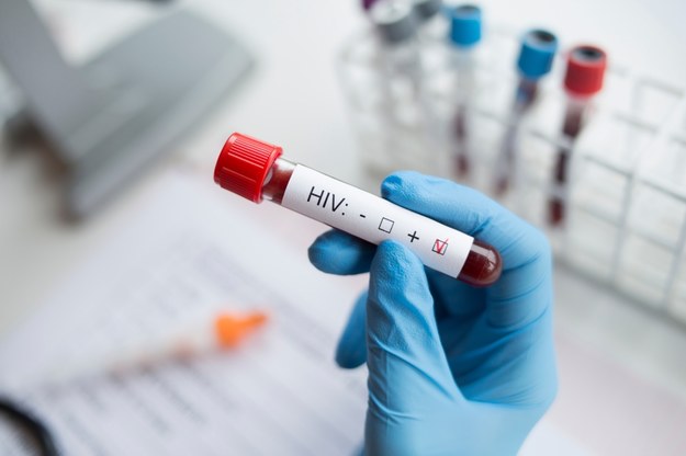 Bezpłatne, dodatkowe testy na HIV