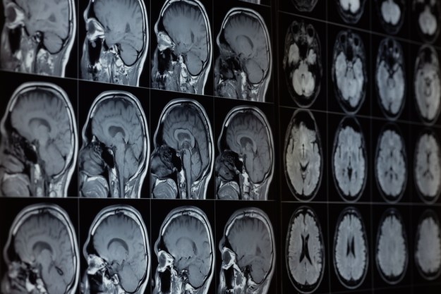 Sztuczna inteligencja a radiologia. "AI nie zawsze ma rację"