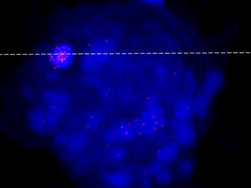 Zdjęcie komórki (niebieska) z atakującym ją ATCV-1 (różowe punkty) /materiały prasowe
