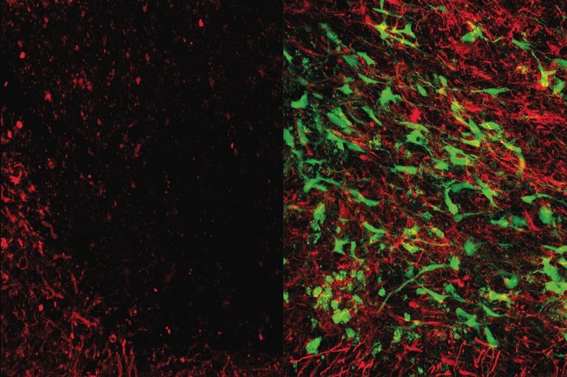 Zdjęcie mikroskopowe pokazujące istotę białą po udarze (po lewej) i ten sam obszar zasiedlony przez komórki glejowe w wyniku nowej terapii (po prawej) /materiały prasowe