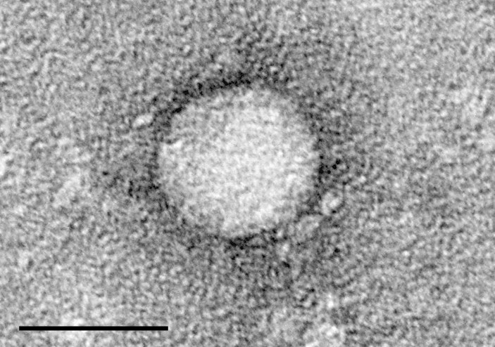 Zdjęcie mikroskopowe przedstawiające wirusa zapalenia wątroby typu C /materiały prasowe