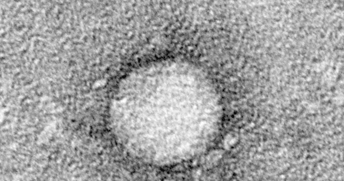 Zdjęcie mikroskopowe przedstawiające wirusa zapalenia wątroby typu C /materiały prasowe