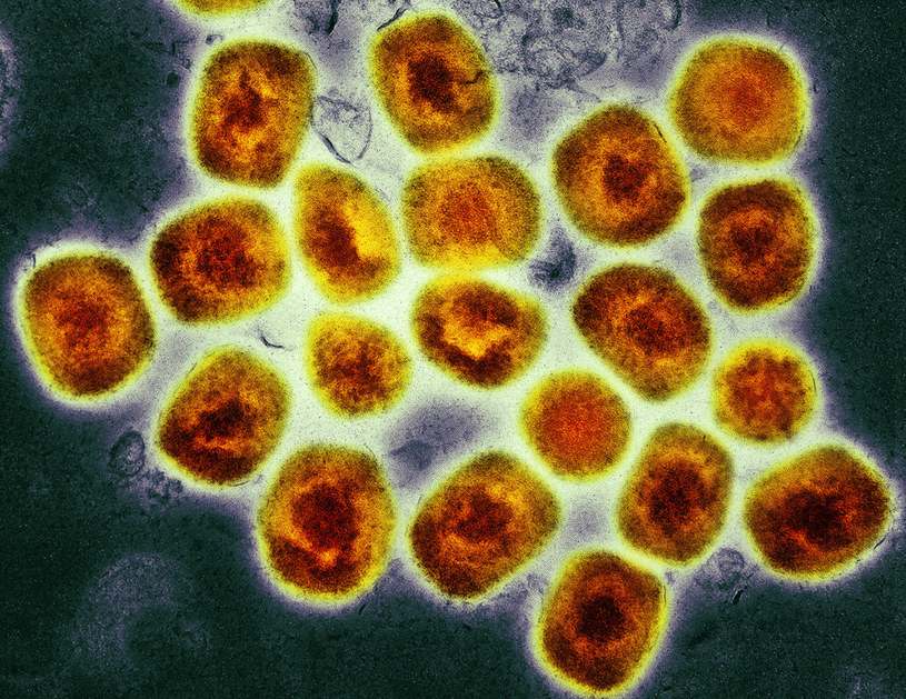 Zdjęcie mikroskopowe wirusa małpiej ospy /National Institutes of Health /East News