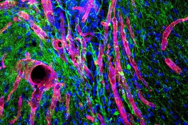 Zdjęcie przedstawia nową tkankę rozwijającą się w miejscu po udarze - na zielono widoczne włókna nerwowe, a na różowo naczynia krwionośne /Fot. UCLA /materiały prasowe