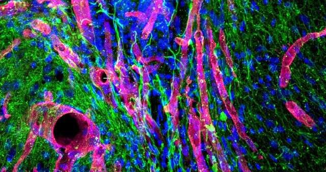 Zdjęcie przedstawia nową tkankę rozwijającą się w miejscu po udarze - na zielono widoczne włókna nerwowe, a na różowo naczynia krwionośne /Fot. UCLA /materiały prasowe