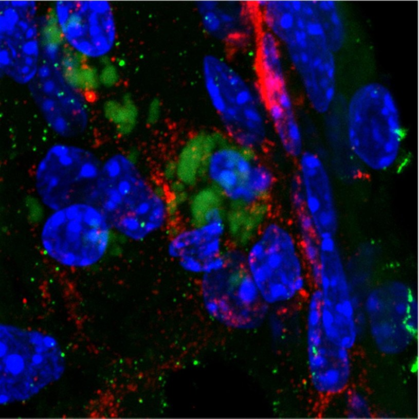 Zdjęcie przedstawiające bakterię wywołującą zmiany Alzheimera (zielona barwa) w mózgu myszy. Wyniki badań naukowców są kontynuacją eksperymentów, które dowiodły, że za rozwojem choroby Alzhaimera stoi wyciek specyficznej toksyny, która atakuje krwiobieg i mózg