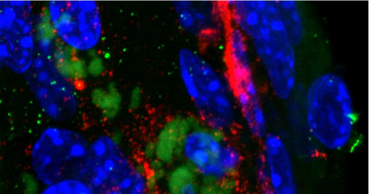 Zdjęcie przedstawiające bakterię wywołującą zmiany Alzheimera (zielona barwa) w mózgu myszy. Wyniki badań naukowców są kontynuacją eksperymentów, które dowiodły, że za rozwojem choroby Alzhaimera stoi wyciek specyficznej toksyny, która atakuje krwiobieg i mózg