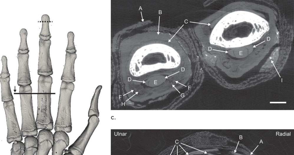 Zdjęcie rentgenowskie egipskiej mumii /materiały prasowe
