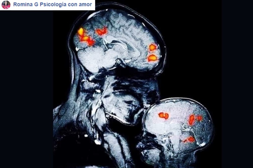 Zdjęcie rezonansu magnetycznego, na którym widać matkę całującą w czoło swojego dwumiesięcznego syna /123RF/PICSEL