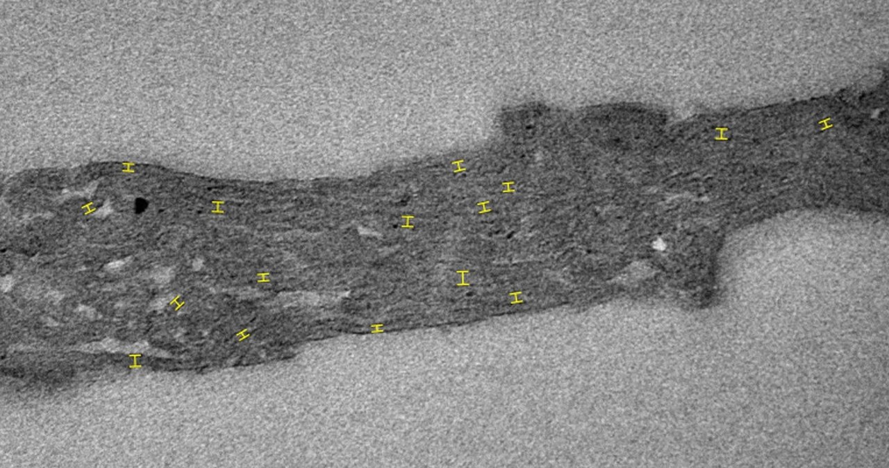 Zdjęcie transmisyjnego mikroskopu elektronowego skamieliny Navifusa majensis z formacji McDermott /Demoulin, C.F., Lara, Y.J., Lambion, A. et al. Oldest thylakoids in fossil cells directly evidence oxygenic photosynthesis. Nature (2024). /materiał zewnętrzny