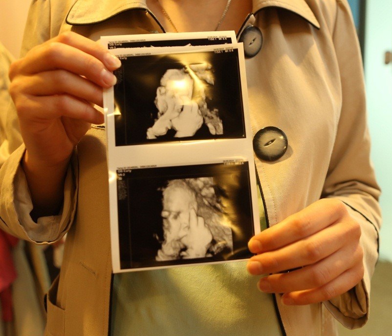 Zdjęcie USG ciąży /materiały prasowe
