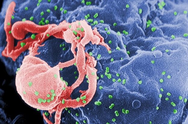 Zdjęcie, wykonane skaningowym mikroskopem elektronowym, przedstawia wirusy (kolor zielony) wydostających się z limfocytu  (Fot. C. Goldsmith) /materiały prasowe