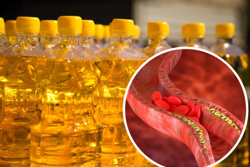 Zdrowiu tętnic sprzyja m.in. spożywanie tłoczonego na zimno oleju rzepakowego /123RF/PICSEL
