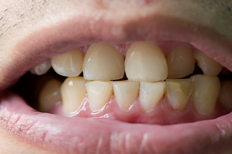 Zęby można wybielić domowym sposobem /123RF/PICSEL