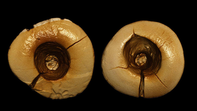 Zęby po wizycie u prehistorycznego stomatologa /fot. Gregorio Oxilia /materiały prasowe