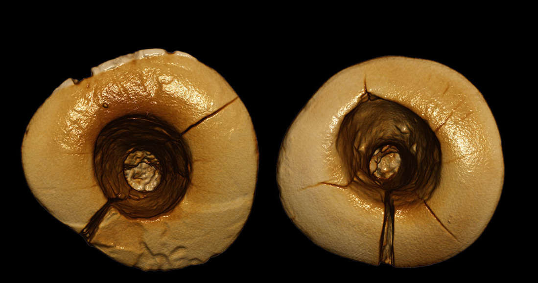 Zęby po wizycie u prehistorycznego stomatologa /fot. Gregorio Oxilia /materiały prasowe