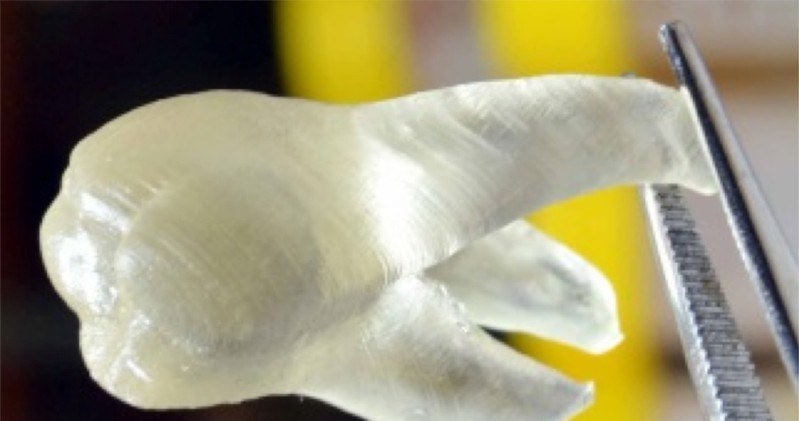 Zęby z drukarki 3D wkrótce staną się standardem? /materiały prasowe