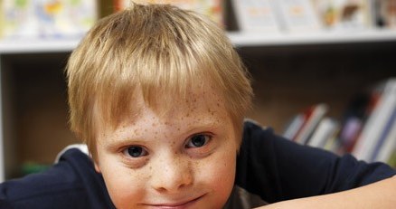 Zespół Downa wywołany jest obecnością dodatkowego chromosomu 21