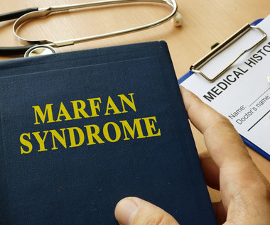 Zespół Marfana: Przyczyny, objawy i leczenie